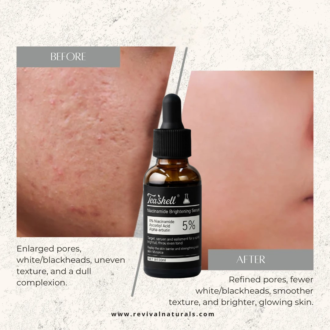 Teashell Niacinamide Glow Serum | (Buy Now)
