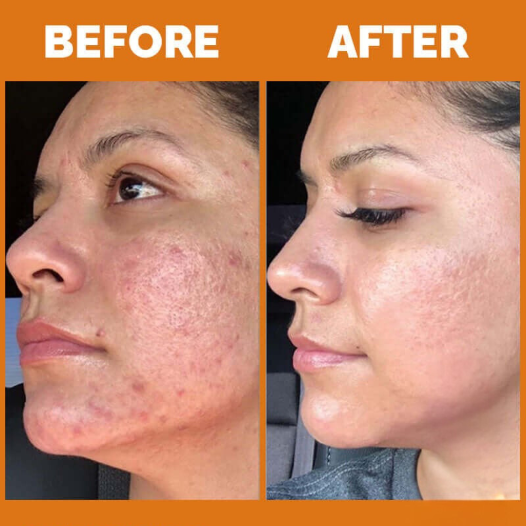 Teashell Niacinamide Glow Serum | (Buy Now)
